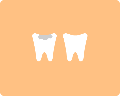 銀歯から白い歯へ