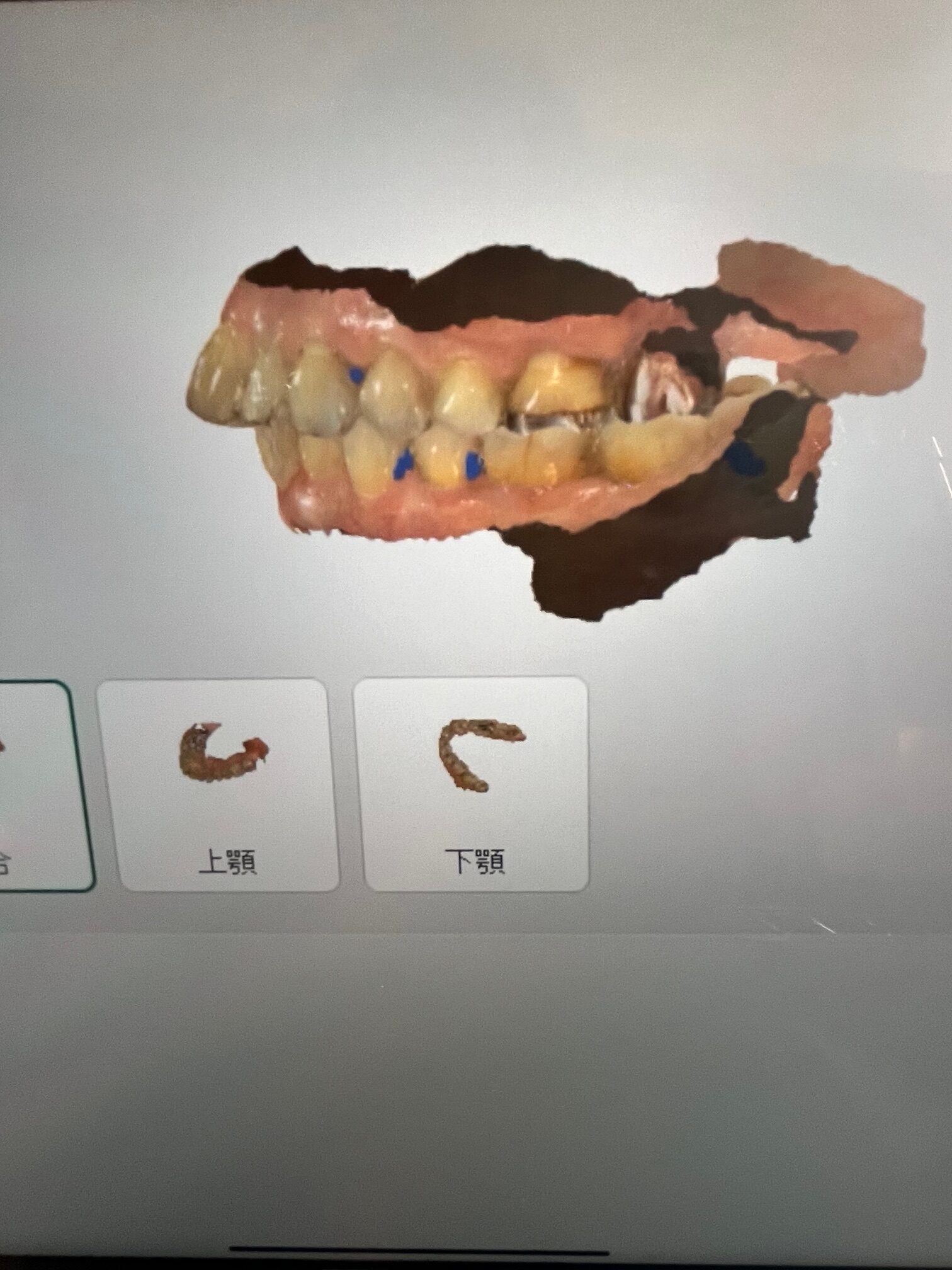 モニター